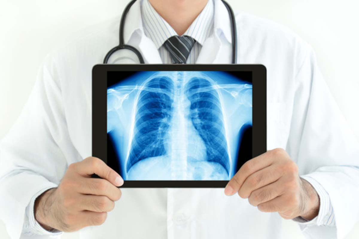 1200 X 800 Digital X-Ray